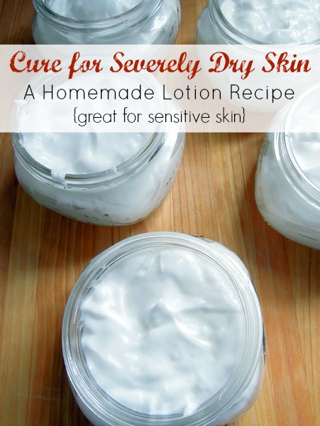 moisturizing diy dry skin cure lotion recipe creativelysouthern