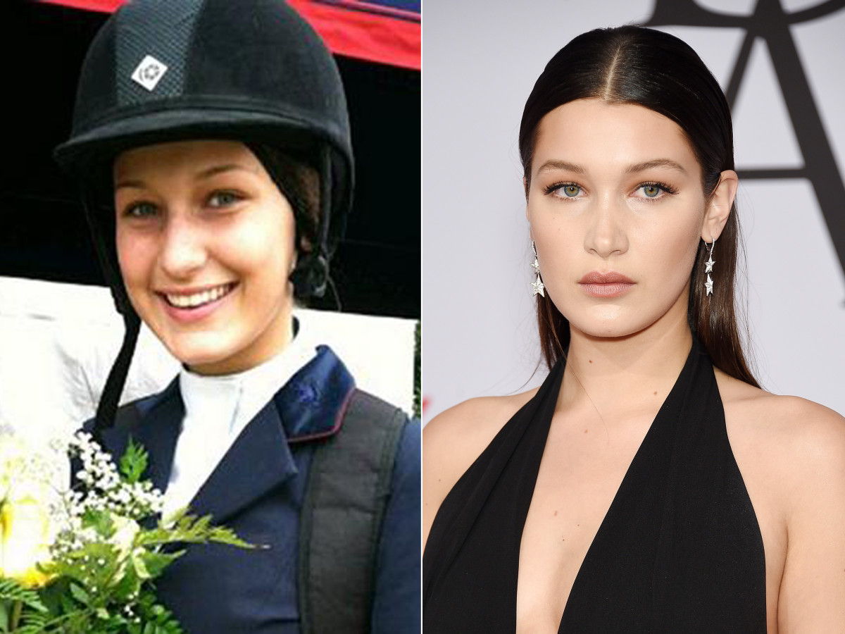 bella hadid before and after 15