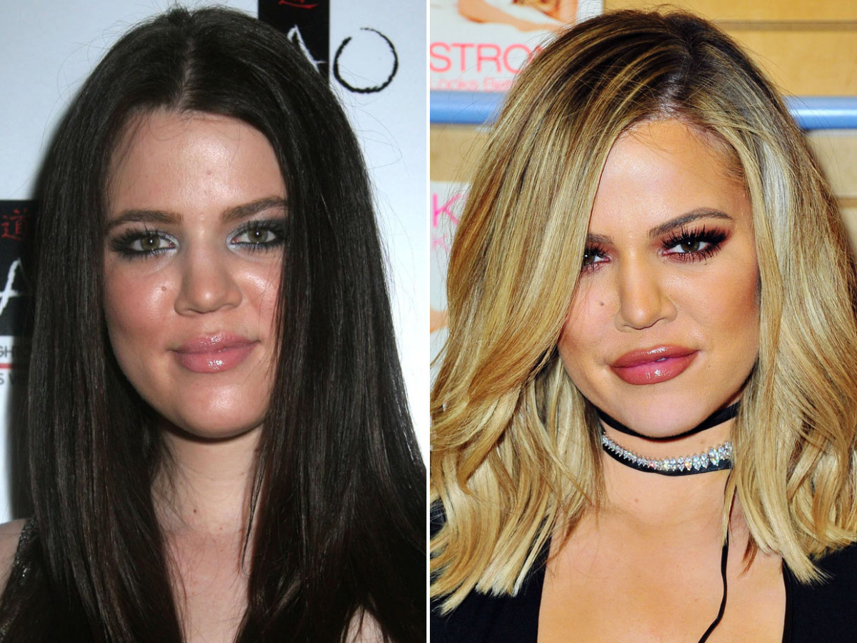 khloe kardashian before and after 1